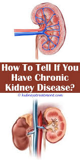 Chronic Kidney Disease You Are Kidney Disease Awareness Chronic Kidney Disease Kidney Disease Symptoms