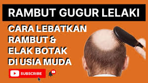 Justeru, ketahui 7 petua melebatkan rambut ini. Rambut Gugur Lelaki Cara Lebatkan Rambut Elak Kepala Botak Youtube
