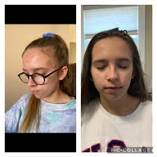 Personal facial care products and routine