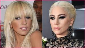 Pop Star Plastic Surgery Before And After Photos Plastic Surgery Before And After Plasticsurgery Beforeandafter Celebrities Celebrity Ladygaga Bob