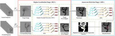Compared to conventional 2d cnn, our 2.5d cnn (2d image with neighbor slices) the proposed casdetnet for detection of mitotic cells is shown in fig.2. Automatic Detection On Intracranial Aneurysm From Digital Subtraction Angiography With Cascade Convolutional Neural Networks Springerlink