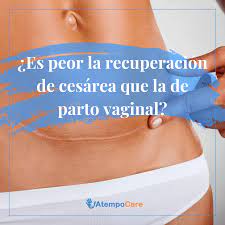 Es Peor La Recuperacion De Cesarea Que La De Parto Vaginal