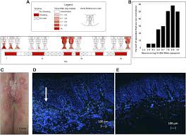 It was hard to grasp. Rapid Localized Spread And Immunologic Containment Define Herpes Simplex Virus 2 Reactivation In The Human Genital Tract Elife