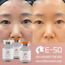 E50 Exosomes Skin and Hair Rejuvenation