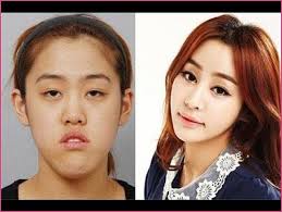 Korean Family Plastic Surgery Korean Plastic Surgery Shocking Plastic Surgery Before And After Korean Plastic Surgery Plastic Surgery Photos Celebrity Plastic Surgery