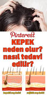 Kepek Neden Olur Kepege Ne Iyi Gelir Movie Posters