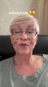 Thread Lift Update: 24 Hours After Treatment