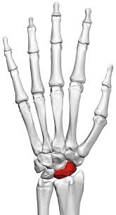 Image result for Hand Fracture