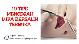 Nama salep untuk luka jahitan. Dr Hana Luka Saya Terbuka Bekerja Di Klinik Ibu Dan Facebook