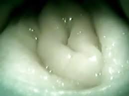 The vagina is a flexible tube that joins the uterus to the vulva. Camera Inside Vagina Porn Videos Xhamster