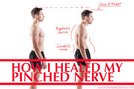How I Healed My Pinched Nerve In Neck Back Pinched Nerve Pinched Nerve In Neck Alexander Technique