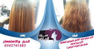 مشغل للبروتين والكرياتين مشغل لعلاج الشعر بالبروتين Incoming Call Screenshot Blog Posts Blog