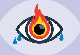 What takes the sting out of a burn. Why Do My Eyes Burn And Water Suddenly For No Apparent Reason Health Essentials From Cleveland Clinic