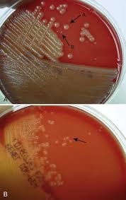 Polystyrene petri plates feature raised rings for stacking … Traditional Cultivation And Identification Basicmedical Key