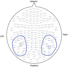 For more information, see negative unicode category or unicode block. Frontiers Neurophysiological Face Processing Deficits In Patients With Chronic Schizophrenia An Meg Study Psychiatry