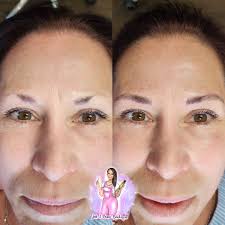 Does anybody have a turtle nest protector?