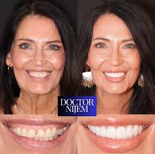 So that's how they eat homework 😂✨ #goldenretriever #denture #repost  @dentistry.blogg . . . . . #dentistry #dentist #teeth #cosmeticdentistry  #medicine #beauty #doctor #aesthetics #cosmetics #health #surgery  #plasticsurgery #odontologia ...