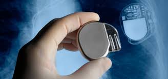 Like a pacemaker, an icd consists of two parts. Living For A Shock Listening To Patients With Implantable Defibrillators Ucsf Science Of Caring