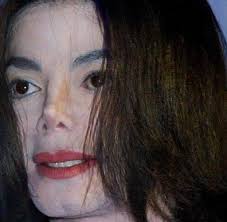 Was passierte mit seiner nase? Michael Jackson Welt