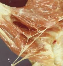 Most common nerve anastomosis pattern. Riche Cannieu Anastomosis Structure Function And Clinical Significance