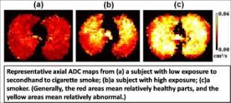 Julian's cat care, in dearborn, mich. Secondhand Smoke Damages Lungs Mris Show