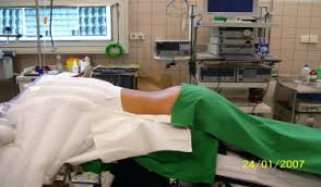 Bandscheibenvorfall Hws Op Dauer