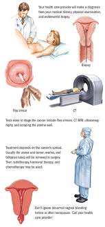 Time is needed for the body to adjust. Uterine Endometrial Cancer Spectrum Health
