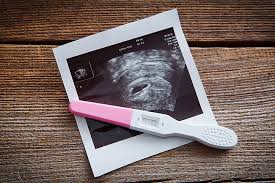 If you still can't access how much does the first prenatal visit cost without insurance please leave a message below. Free Ultrasound Testing Innervisions Healthcare Free Pregnancy Center Des Moines Iowa