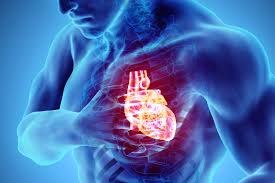 What You Should Know About Cardiac Arrest