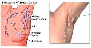 Pin On Health