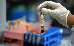 We did not find results for: Leucemia Fulminante Cos E Sintomi E Diagnosi
