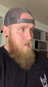 Sick boy #foryou #foryoupage