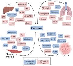 Image result for Cachexia in Cancer