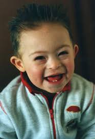 Valerio Catoia: il ragazzo con la sindrome da 'atleta'