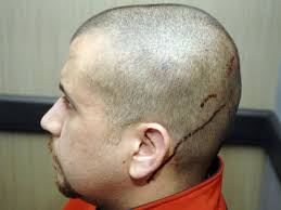 Cnn's don lemon recounts the details of florida teen trayvon martin's last minutes. Trayvon Martin Shooting New Evidence Shows Wounds On Zimmerman S Head Thc Found In Martin S Body Cbs News