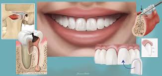 Dental Illustrations | Images of Teeth, Tooth Anatomy & Related Anatomy