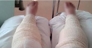 Inilah hukum mencukur bulu kemaluan menurut islam. Wanita Ini Salah Cukur Bulu Kaki Akibatnya Mengerikan Islam Itu Pilihan Ku