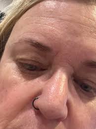 Concealer for vitiligo and fine lines?