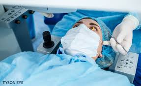 Image result for Cataract Extraction