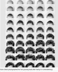 There are four stages in the hair growth cycle, each resulting in growth, shedding, or resting. Stages Of Growing Hair Out Men Novocom Top