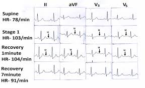 Image result for U Wave
