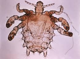 Image result for pubic lice symptoms