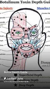 Botox injection depth chart