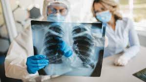 Dapatkan berita terkini mengenai paru+paru+berair dan cari tajuk utama berita terkini mengenai paru+paru+berair dari astro awani. Pneumonia Sering Menyertai Covid 19 Bisakah Disembuhkan