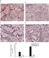 Image result for svrab na k%u016F%u017Ei