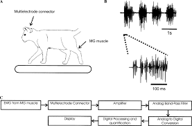Image result for Electromyogram