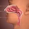Flat nasal bridge and epicanthal folds : 1