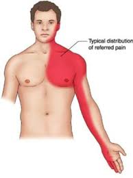Image result for Angina Pectoris