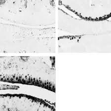 Ver más ideas sobre mandalas, mandalas pintadas, mandalas de colores. Pdf Use Of Animal Models Of Osteoarthritis In The Evaluation Of Potential New Therapeutic Agents