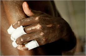 Image result for Scleroderma geaster